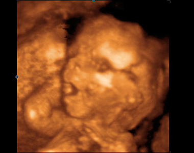17.-20. týden vývoje miminka