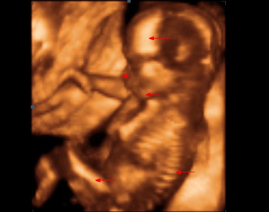 13.-16. týden vývoje miminka