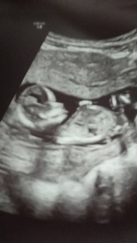 Těhotenství | Babyonline.cz